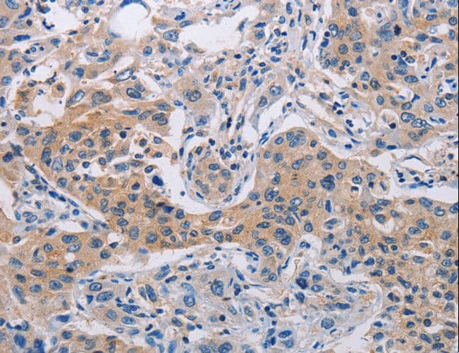 CASP10 / Caspase 10 Antibody