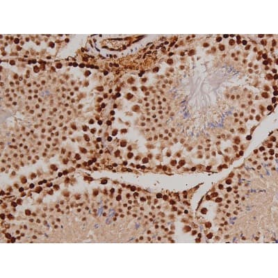 FAK / Focal Adhesion Kinase Antibody (phospho-Tyr397)
