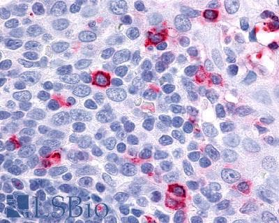 PathPlus™ Polyclonal Rabbit anti-Human CCR7 Antibody (N-Terminus, IHC)