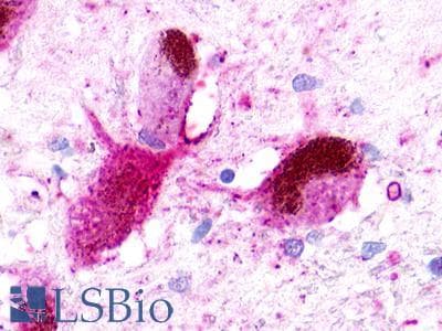PathPlus™ Polyclonal Rabbit anti-Human NMUR1 Antibody (C-Terminus, IHC)