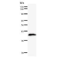 LDOC1 Antibody (clone 2507C1a)