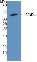 ACTN4 Antibody (aa1-269, Cy3)