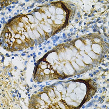 Selenium Binding Protein 1 Antibody