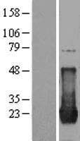 Human HRAS / H-Ras Protein (Over-Expression Lysate Myc-DDK (Flag))