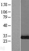 SBDS Protein (Over-Expression Lysate Myc-DDK (Flag))