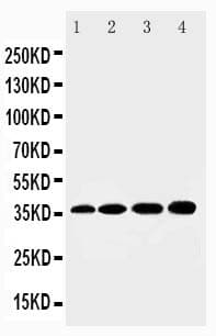 Polyclonal Rabbit anti-Human HSD17 / HSD17B1 Antibody (aa29-43, IHC, WB)