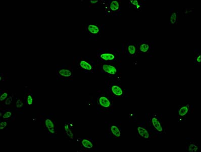 HIST1H2BB Antibody