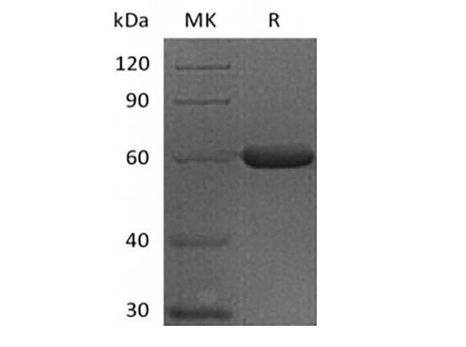 Human FGL1 / Hepassocin Protein (Recombinant Fc, C-terminus)