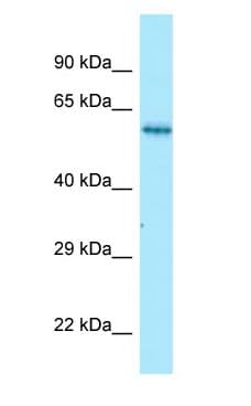 Polyclonal Rabbit anti-Human NMD3 Antibody (aa391-440, WB)