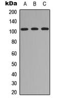 Polyclonal Rabbit anti-Human ITIH4 Antibody (Internal, WB)