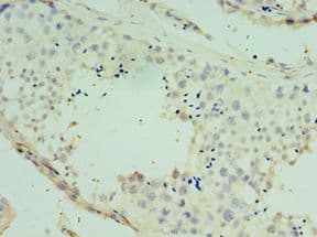 SPAG16 Antibody (aa1-183)