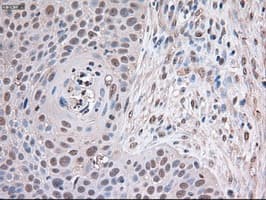 TRIM33 / TIF1-Gamma Antibody (clone OTI6B7)