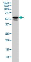 TBL1XR1 / TBLR1 Antibody (clone 3G7)