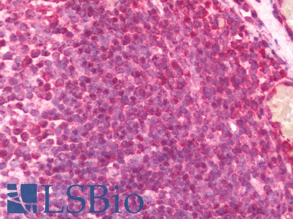 IHC-plus™ DNAJC13 Antibody