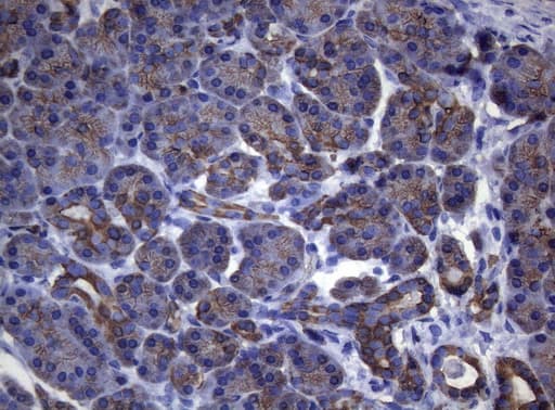 Monoclonal Mouse anti-Human KRT18 / CK18 / Cytokeratin 18 Antibody (clone OTI5E4, aa69-372, IHC, WB)