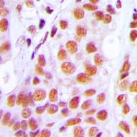 Polyclonal Rabbit anti-Human PRPF3 Antibody (IHC, IF, WB)