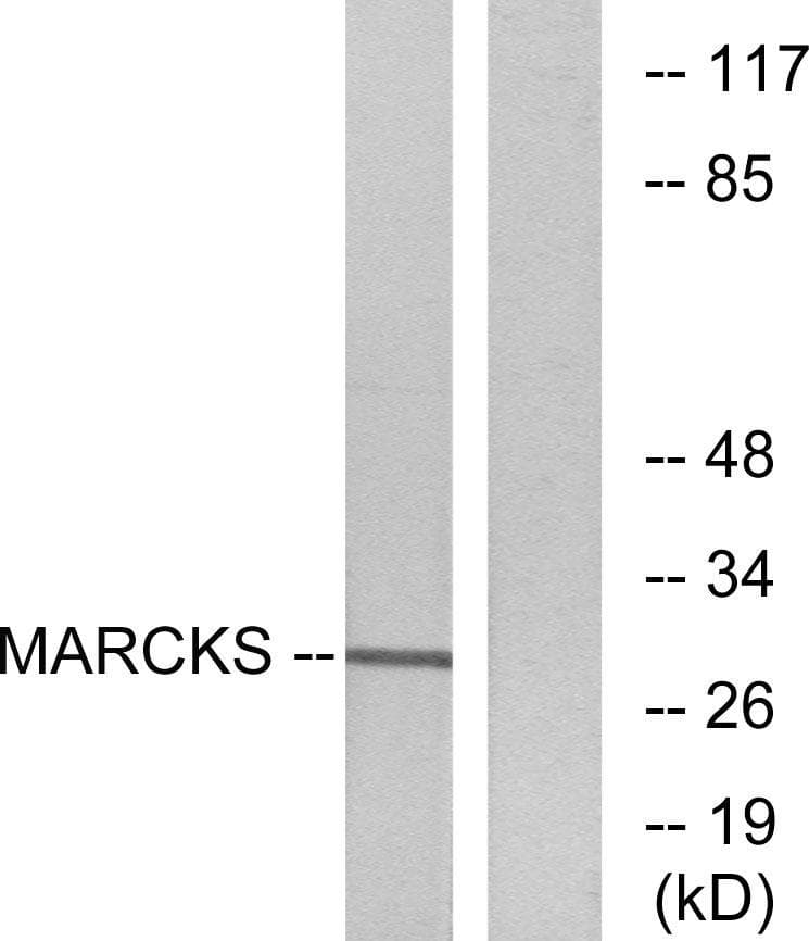 MARCKS Antibody (p158)