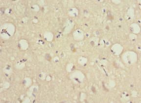 PRUNE2 Antibody