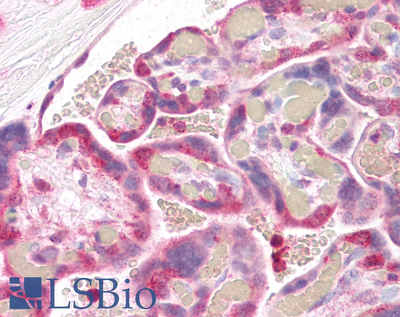IHC-plus™ Polyclonal Rabbit anti-Human STXBP2 Antibody (aa58-70, IHC, WB)
