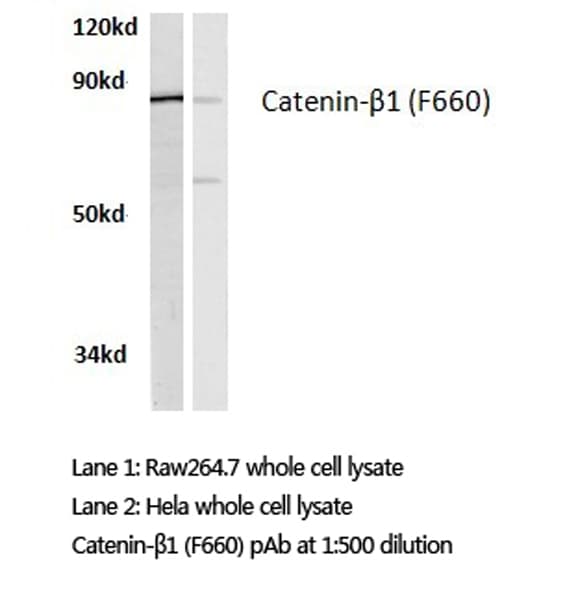 CTNNB1 / Beta Catenin Antibody (Phe660)