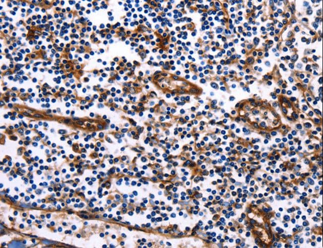 Polyclonal Rabbit anti-Human DUSP6 / MKP3 Antibody (IHC, WB)