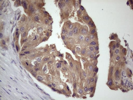 Monoclonal Mouse anti-Human BMF Antibody (clone OTI6F3, IHC, WB)