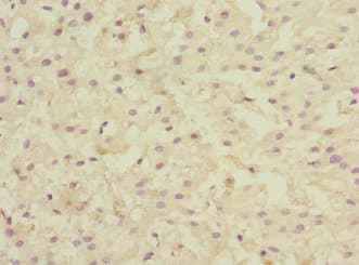 LSS Antibody