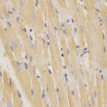 SFTPC / Surfactant Protein C Antibody