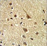 Polyclonal Rabbit anti-Human GLO1 / Glyoxalase I Antibody (aa23-51, IHC, IF, WB)