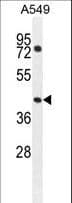 GTPBP8 / HSPC135 Antibody (aa122-150)
