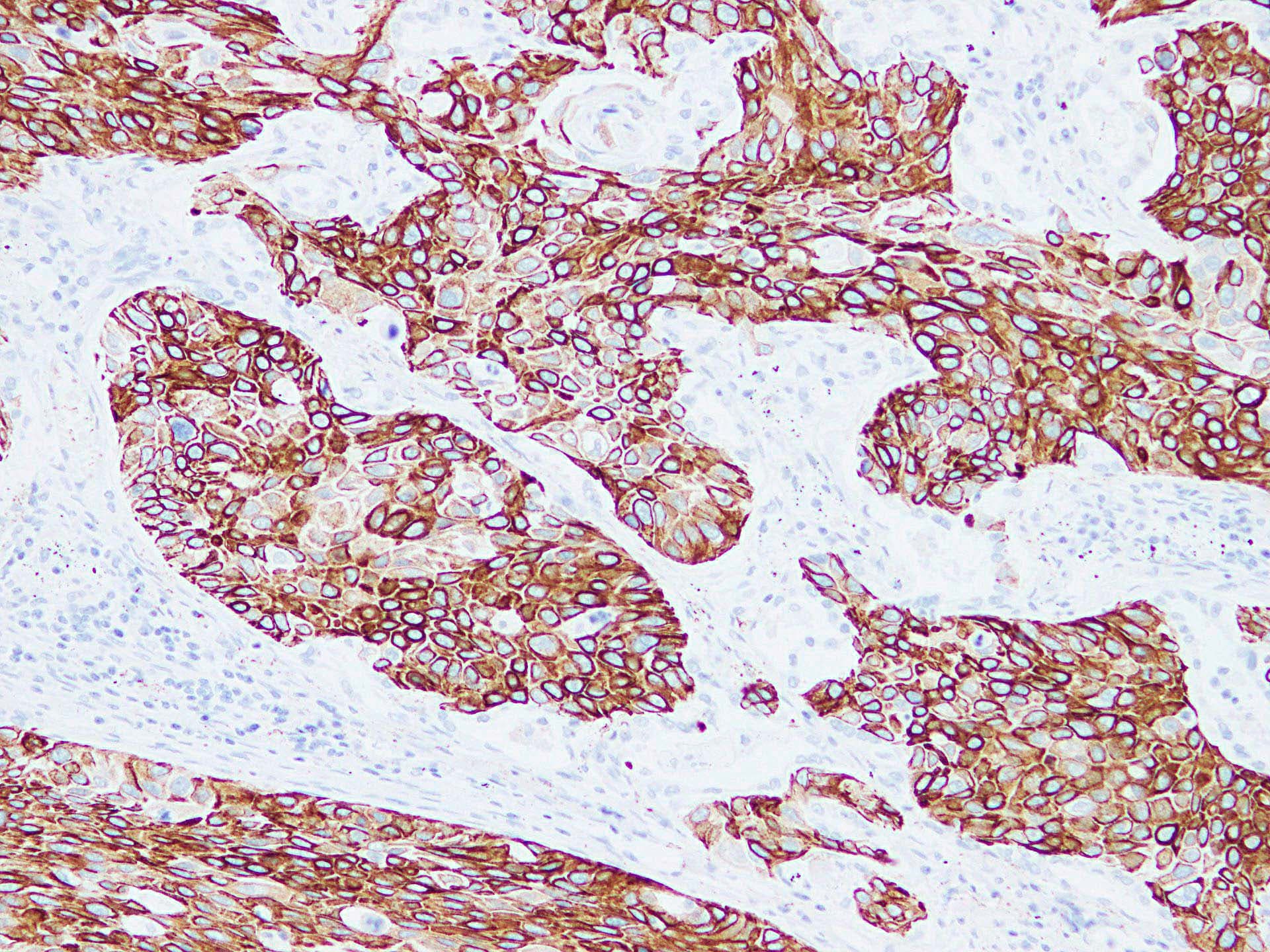 PathPlus™ Monoclonal Mouse anti-Human KRT15 / CK15 / Cytokeratin 15 Antibody (IHC, WB)