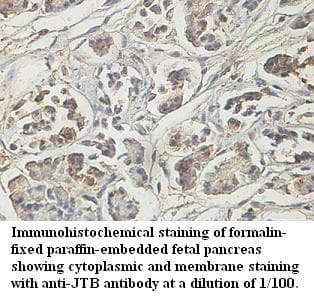 Polyclonal Rabbit anti-Human JTB / PAR Antibody (aa16-99, IHC, WB)