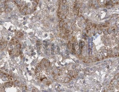 SIRT3 / Sirtuin 3 Antibody
