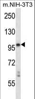 LTK Antibody (aa795-822)
