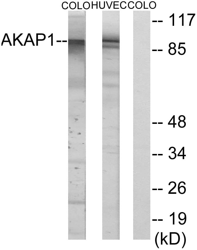 AKAP1 / AKAP Antibody (aa281-330)