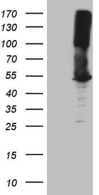 Monoclonal Mouse anti-Human ASS1 / ASS Antibody (clone OTI1B10, C-Terminus, WB)