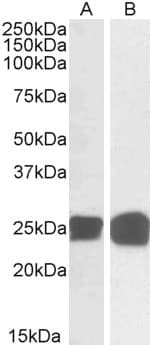 IHC-plus™ GRB2 Antibody (aa206-217)
