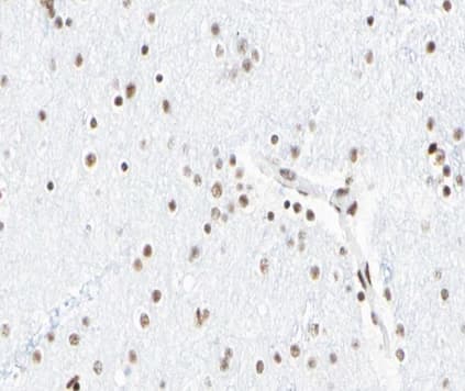 Polyclonal Rabbit anti-Human Histone H3 Antibody (Acetyl-Lys18, IHC, IF, WB)
