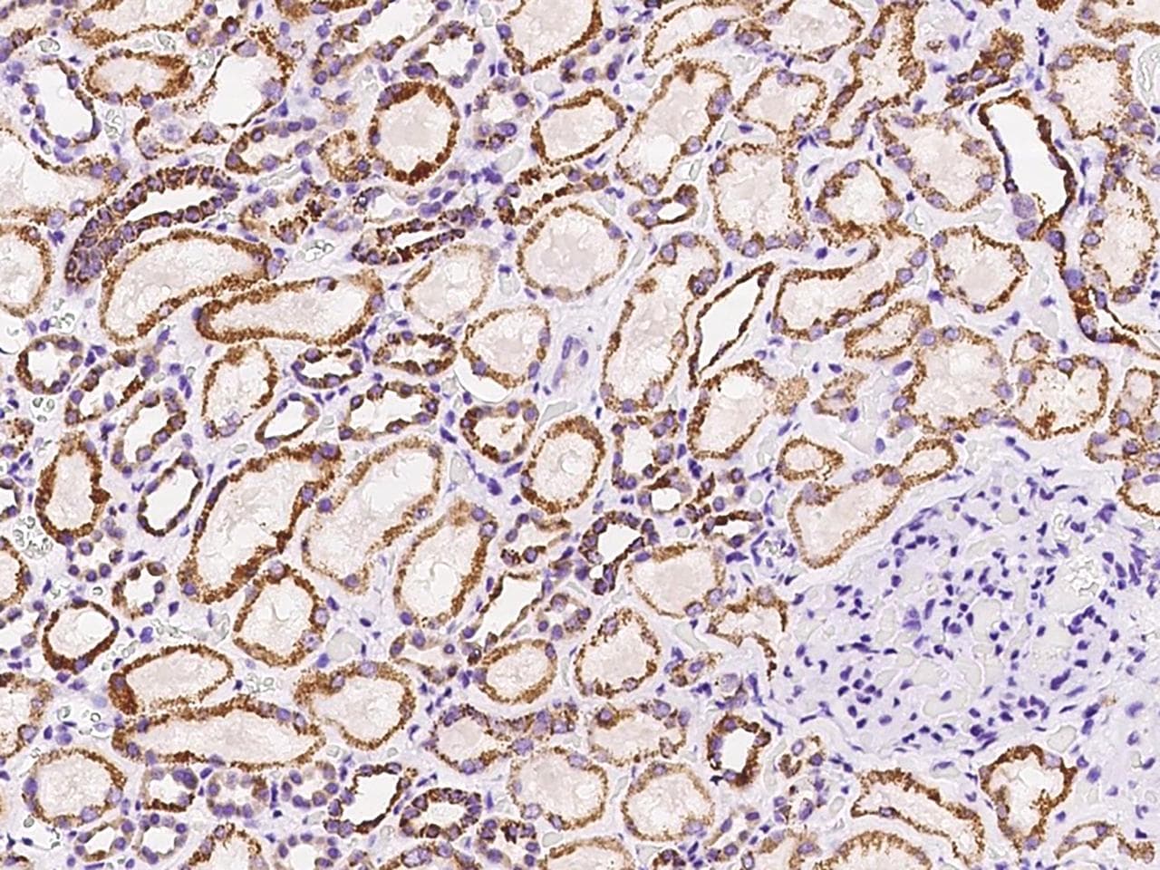 Polyclonal Rabbit anti-Human MTHFD2 Antibody (IHC)