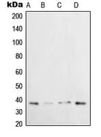 XRCC3 Antibody (Internal)