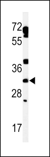 TBC1D7 Antibody (aa150-179)