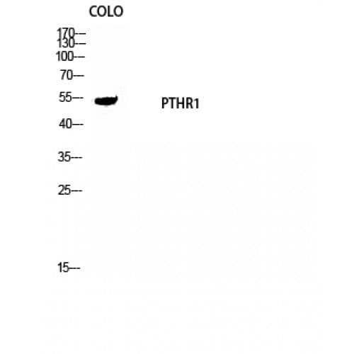 Polyclonal Rabbit anti-Human PTHR / PTHR1 Antibody (120-200 aa, Internal, IHC, IF, WB)