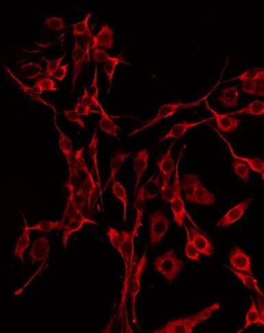 DBH/Dopamine Beta Hydroxylase Antibody
