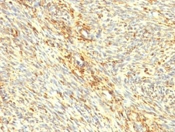 TGM2 / Transglutaminase 2 Antibody (clone TGM2/419)
