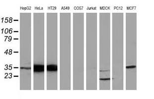 ANXA3 / Annexin A3 Antibody (clone OTI1F11)