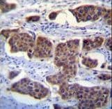 Polyclonal Rabbit anti-Human Paralemmin 3 / PALM3 Antibody (aa546-574, IHC, WB)