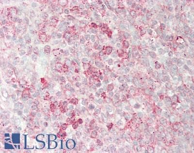 PKN1 Antibody (aa615-874)