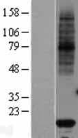 VKORC1 Protein (Over-Expression Lysate Myc-DDK (Flag))