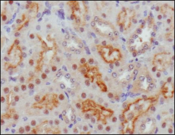 SHH / Sonic Hedgehog Antibody (aa1-75)