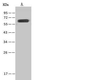 INA / Alpha Internexin Antibody (Preservative Free)